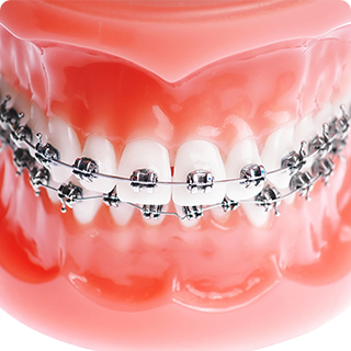 矯正歯科　Orthodontic