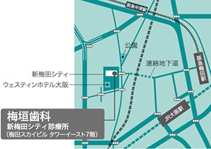 アクセスマップ