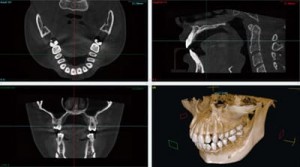 dental-ct_img002