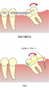 implant_img013