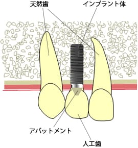 実際の治療費の例