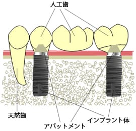 実際の治療費の例